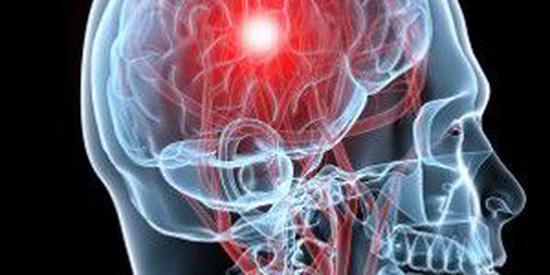 Cerebral Hemodynamics Modeling