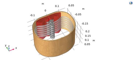 Noninvasive Electrical Stimulation of the Spinal Cord for Pain Management